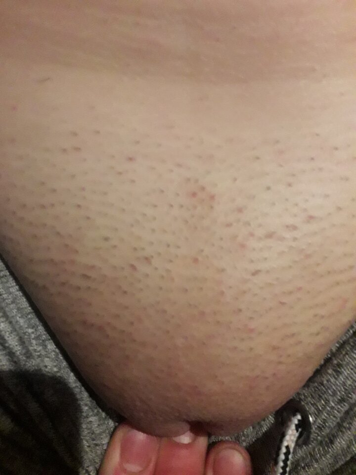 20220210_201539.jpg - kusy13