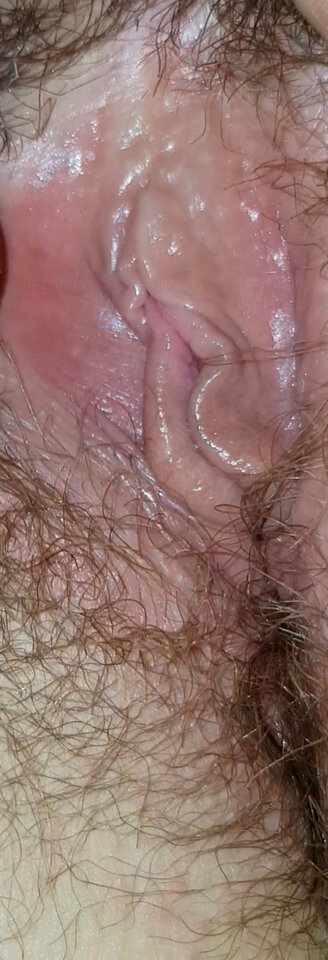 InShot_20220213_182444304.jpg - Carpatia15back