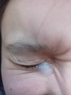 Dostała niechcący w oko