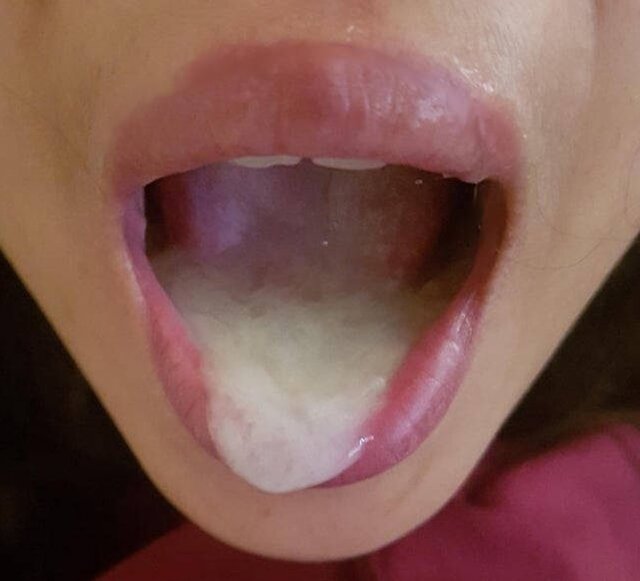 mee2.jpg - transka1998