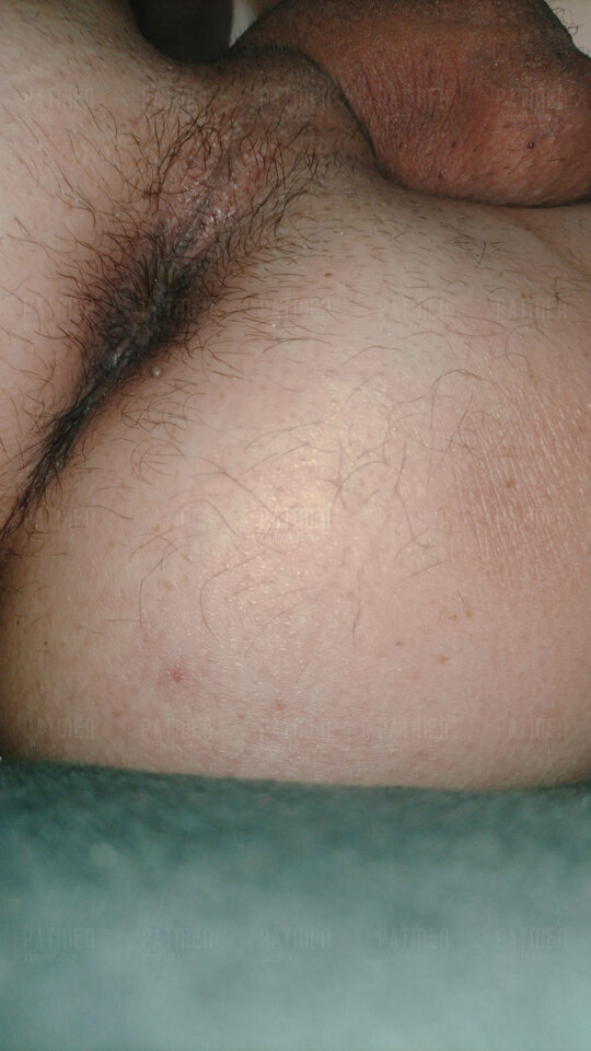 IMG_20220305_132420.jpg - Patmen