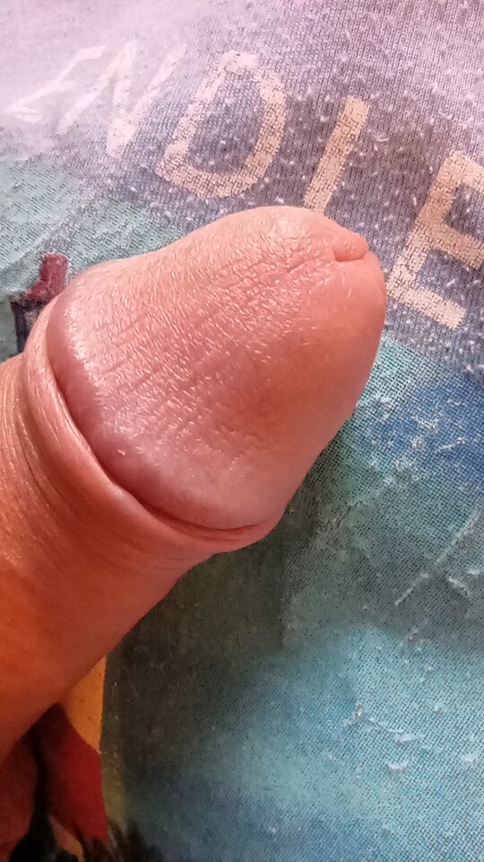 IMG_20220315_070231--.jpg - 6na9na72