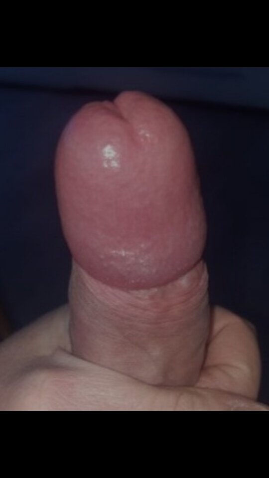 Screenshot_20220407-150027_Gallery.jpg - Onizkoszalina