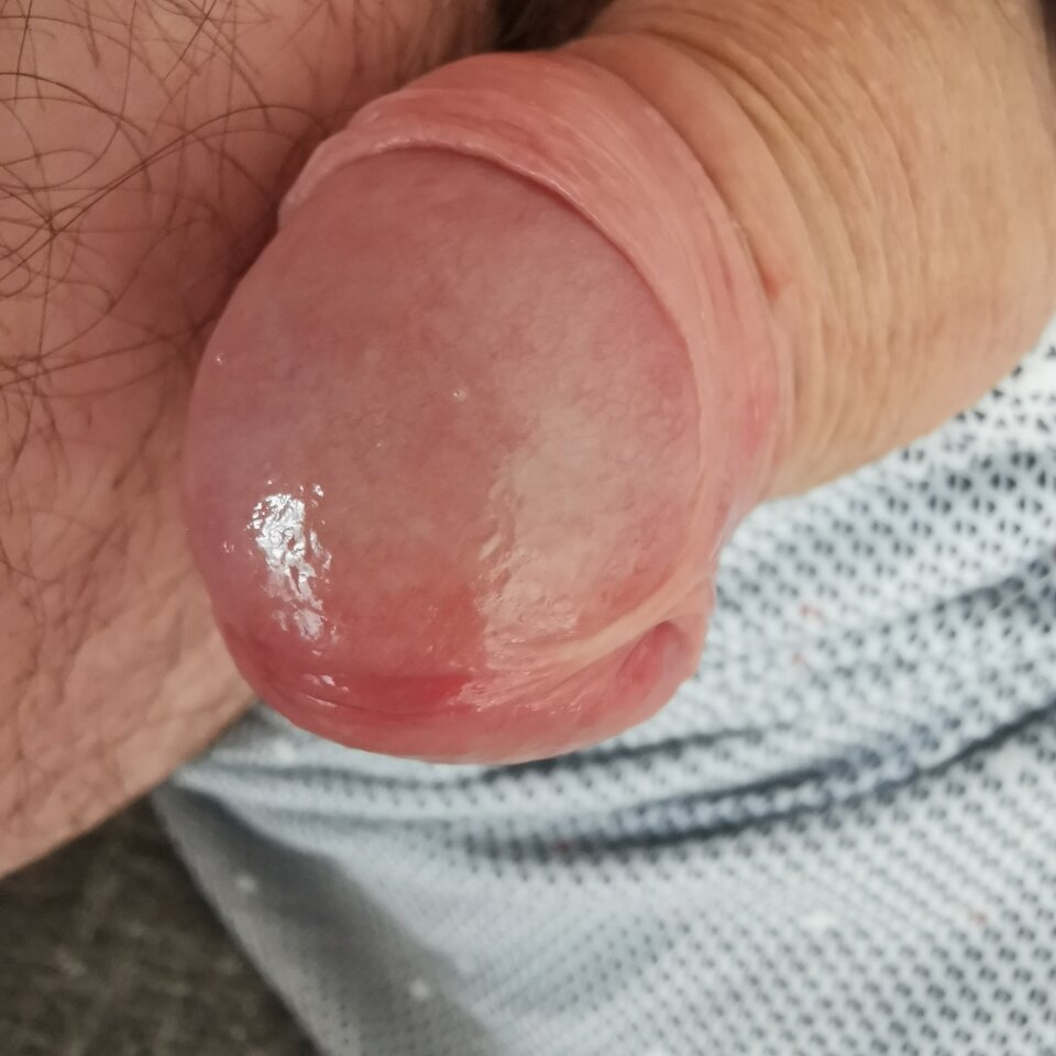 IMG_20220417_115702.jpg - Zi0001