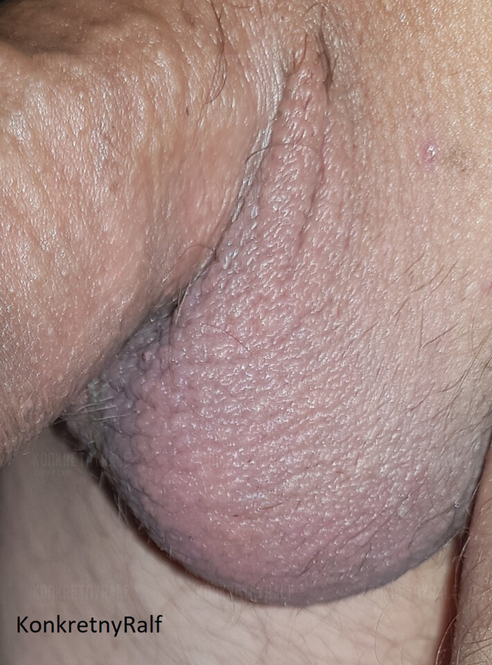 101.jpg - KonkretnyRalf