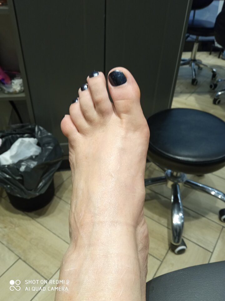 Zaś czarny ☺️ - Smieszka80