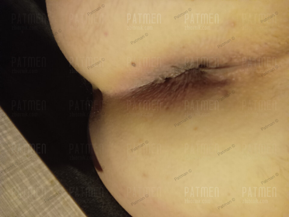 IMG_20220422_201132.jpg - Patmen