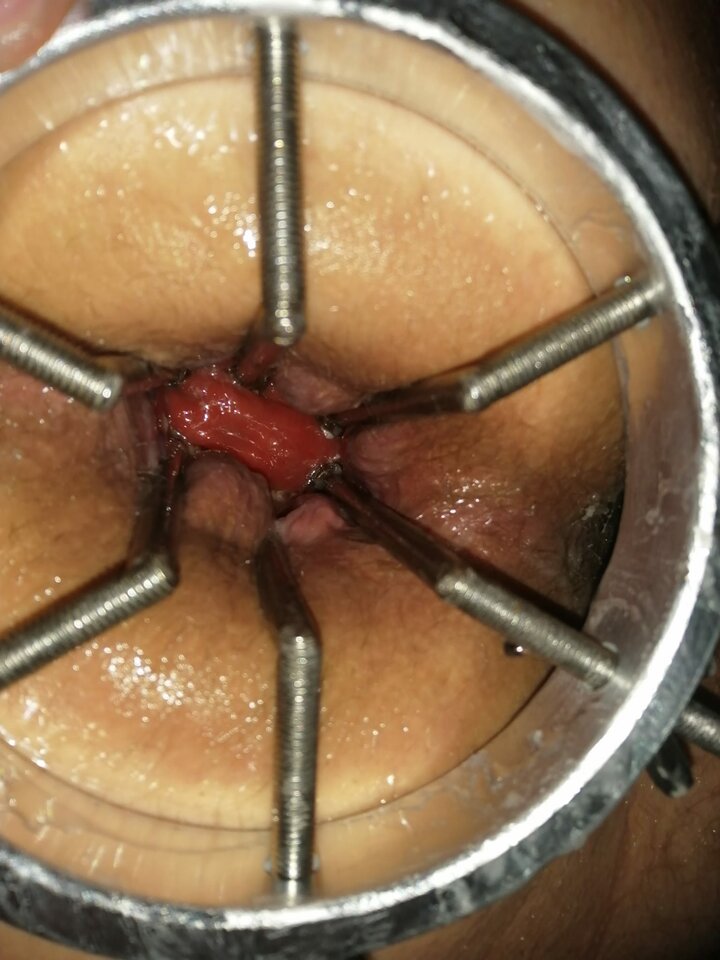 IMG-20220424-WA0013.jpg - Pilsting111