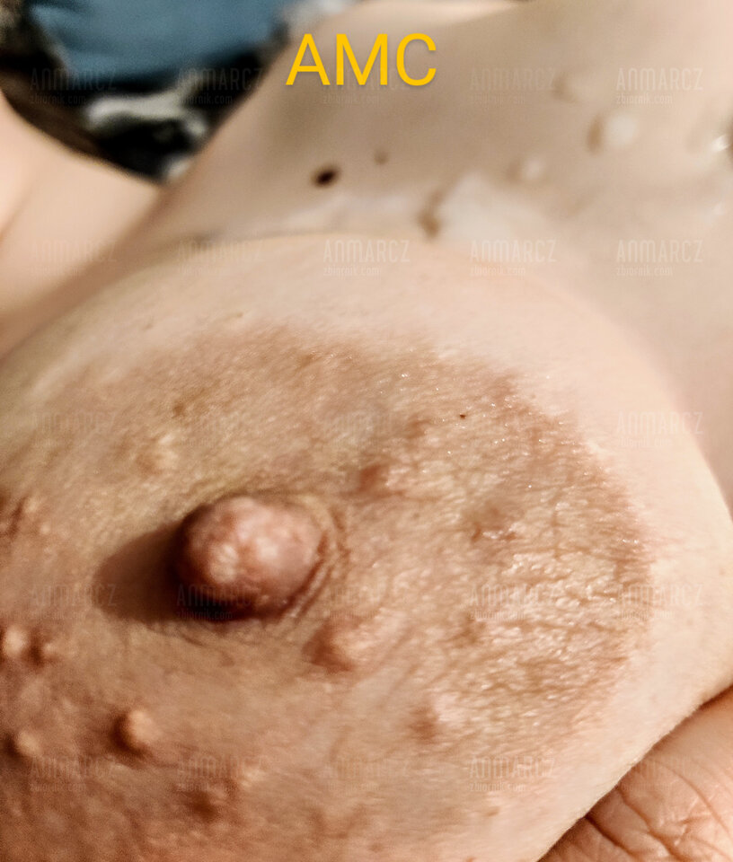 IMG_20220426_010909~3.jpg - Anmarcz