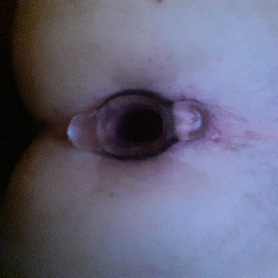 16537768528398650647687963411529.jpg - Palciusia