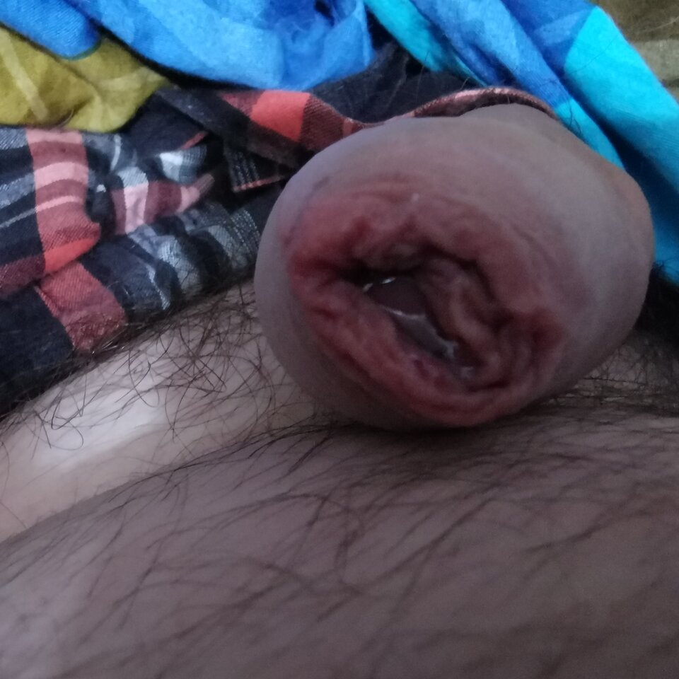 IMG_20220601_101138.jpg - Zi0001