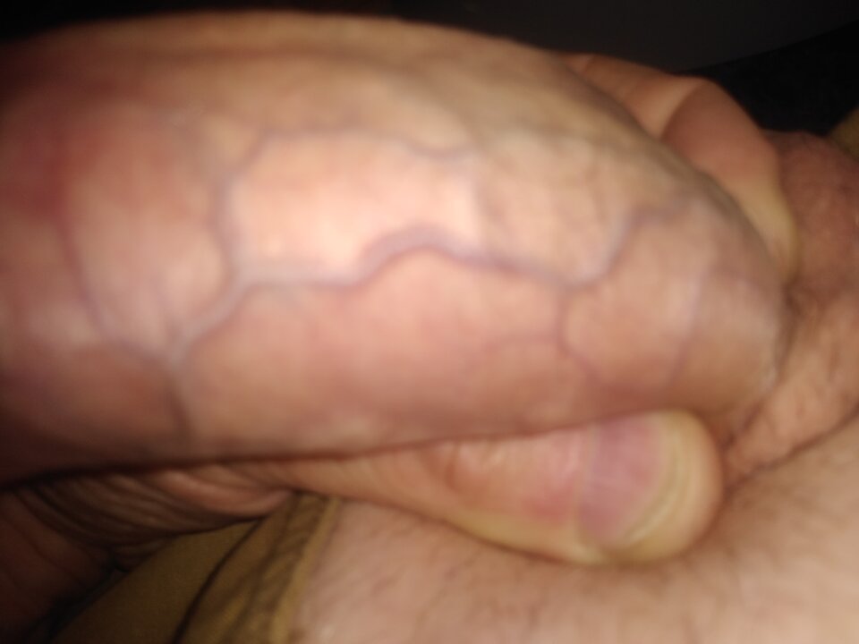 16546131276937582679033088771434.jpg - twoeyes