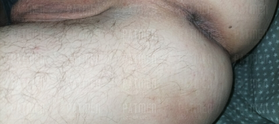 IMG_20220610_003107_TIMEBURST3.jpg - Patmen