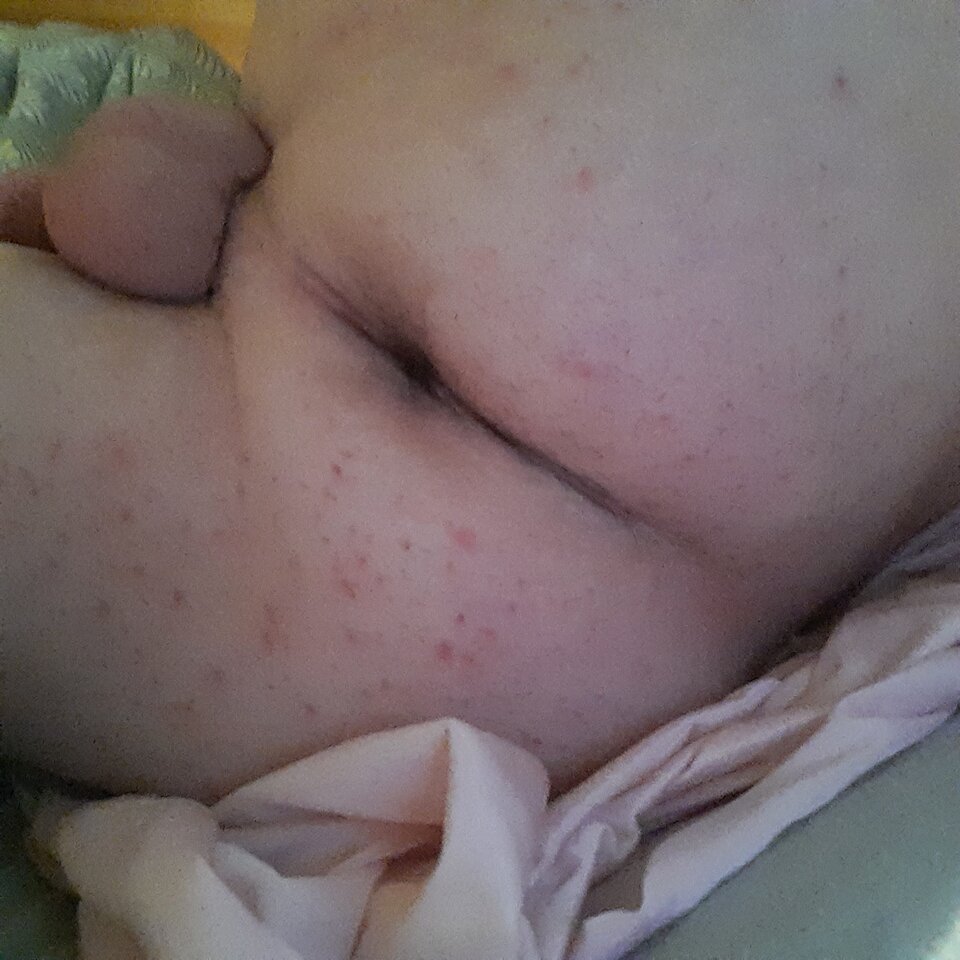 16548922521803327312541395556239.jpg - Palciusia