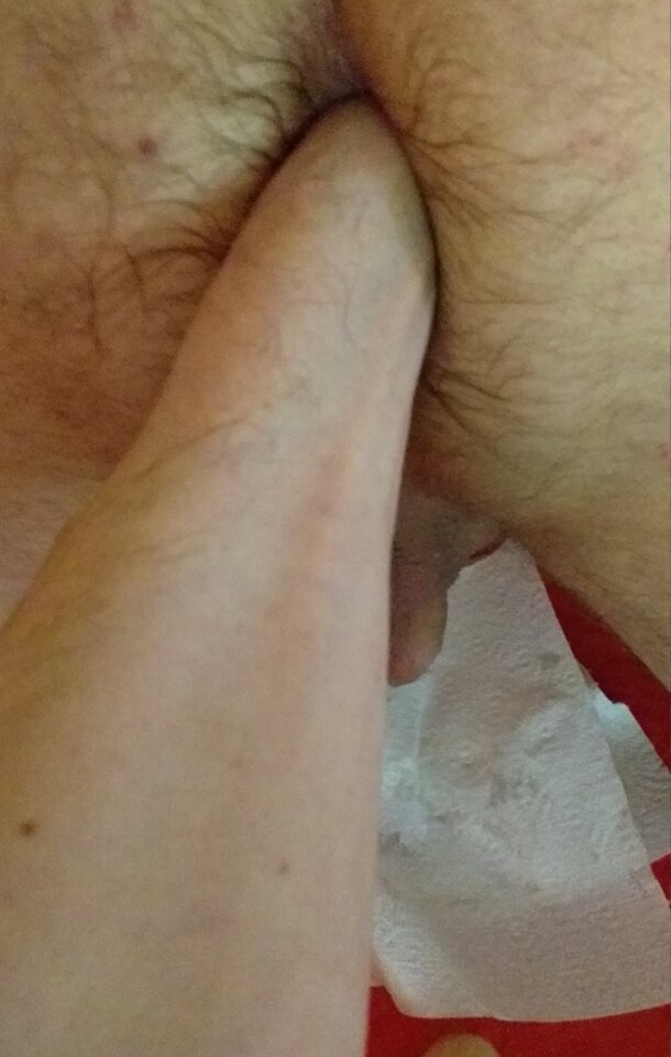 Pomocna dłoń kumpla5 - wlochaty81