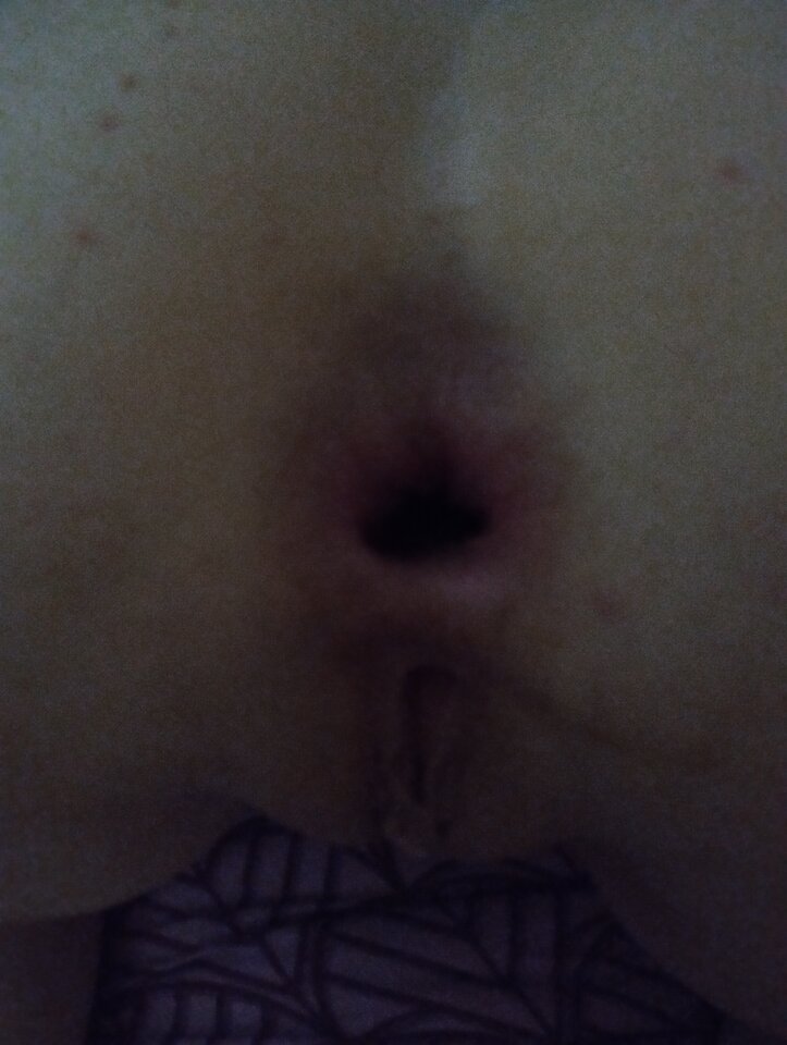 IMG_20220701_110358.jpg - jebusek11