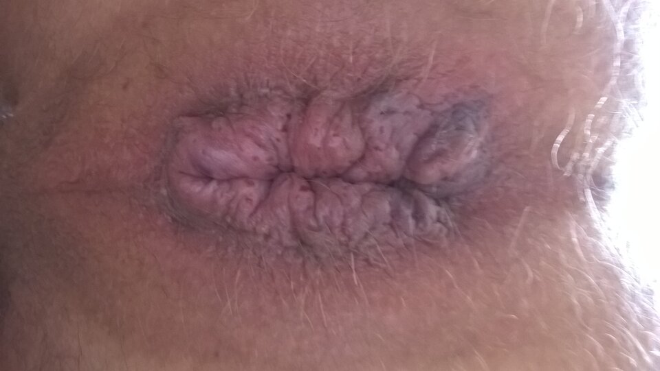 SAVE_20220704_074402.jpg - nowy7575