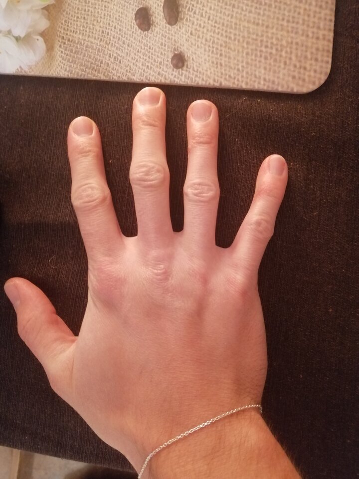 IMG_20220118_220133.jpg - mojekontoo