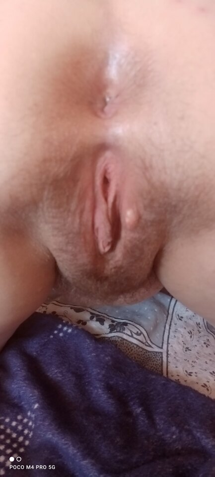 IMG_20220721_162733.jpg - Napaleni75