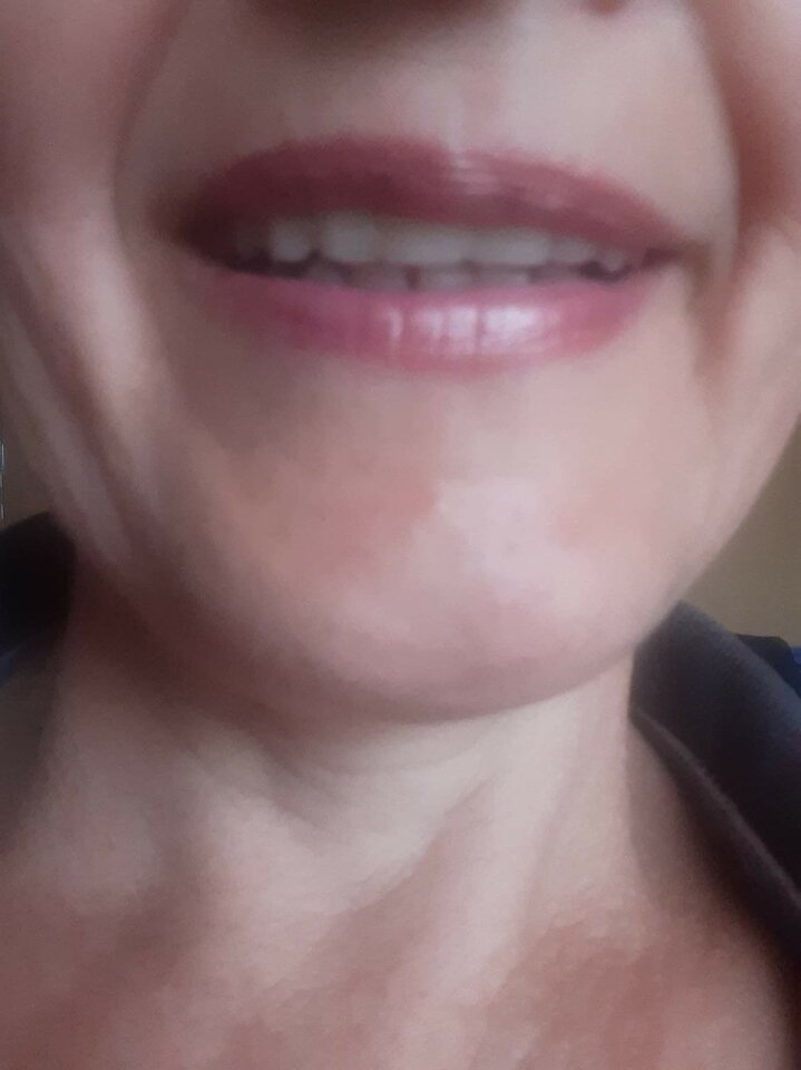 received_1093776351534920.jpeg - Matisek25