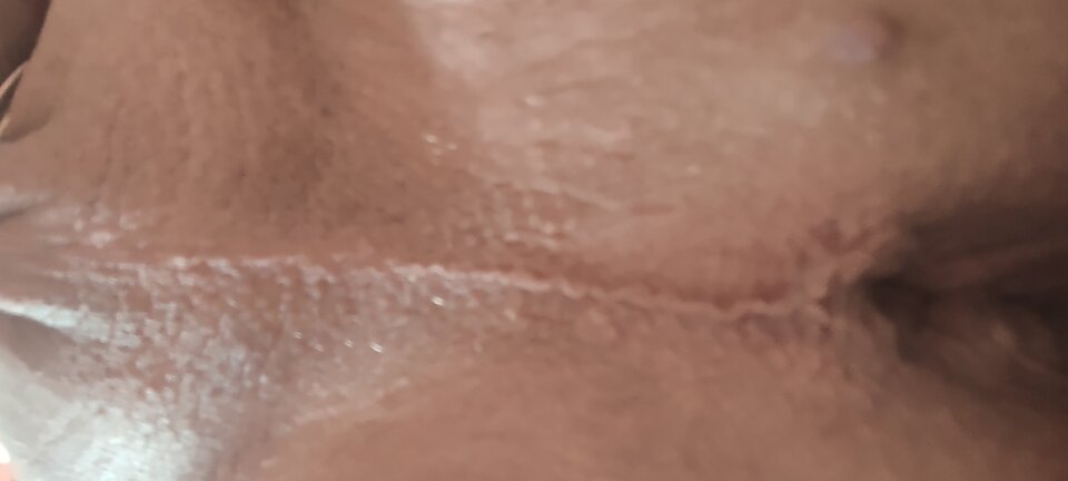 IMG_20220726_110058278.jpg - Bolo0803