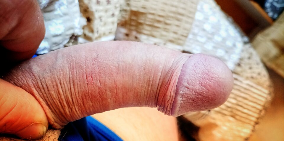 IMG-20220728-WA0000-01.jpeg - Gnatu7