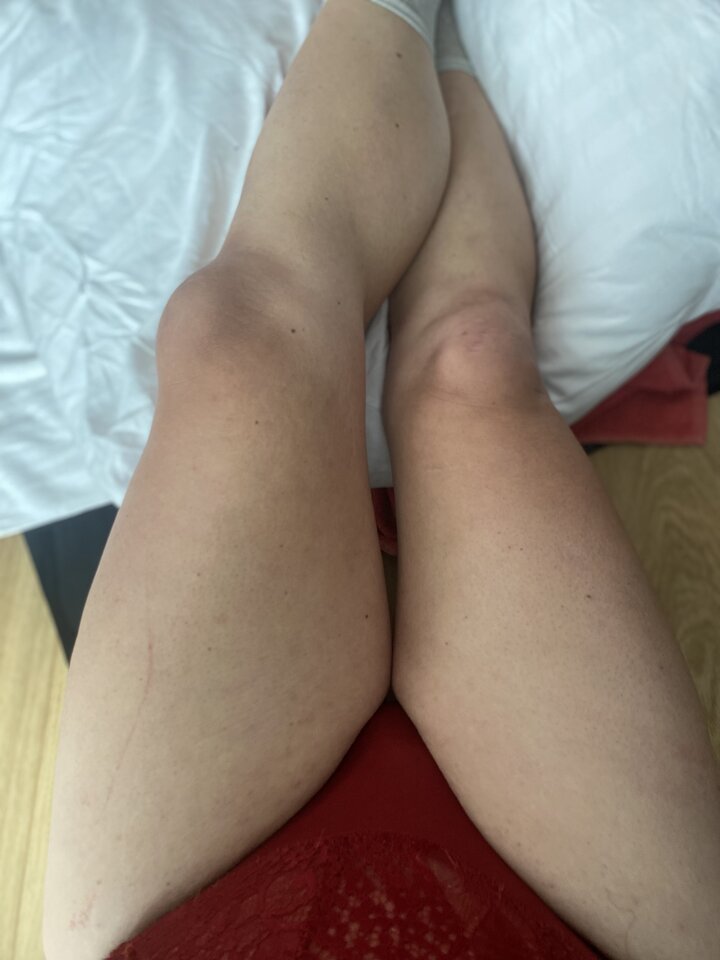 0AE43A69-60CE-4FBB-9A97-125B755A2A72.jpeg - uleglakrysia