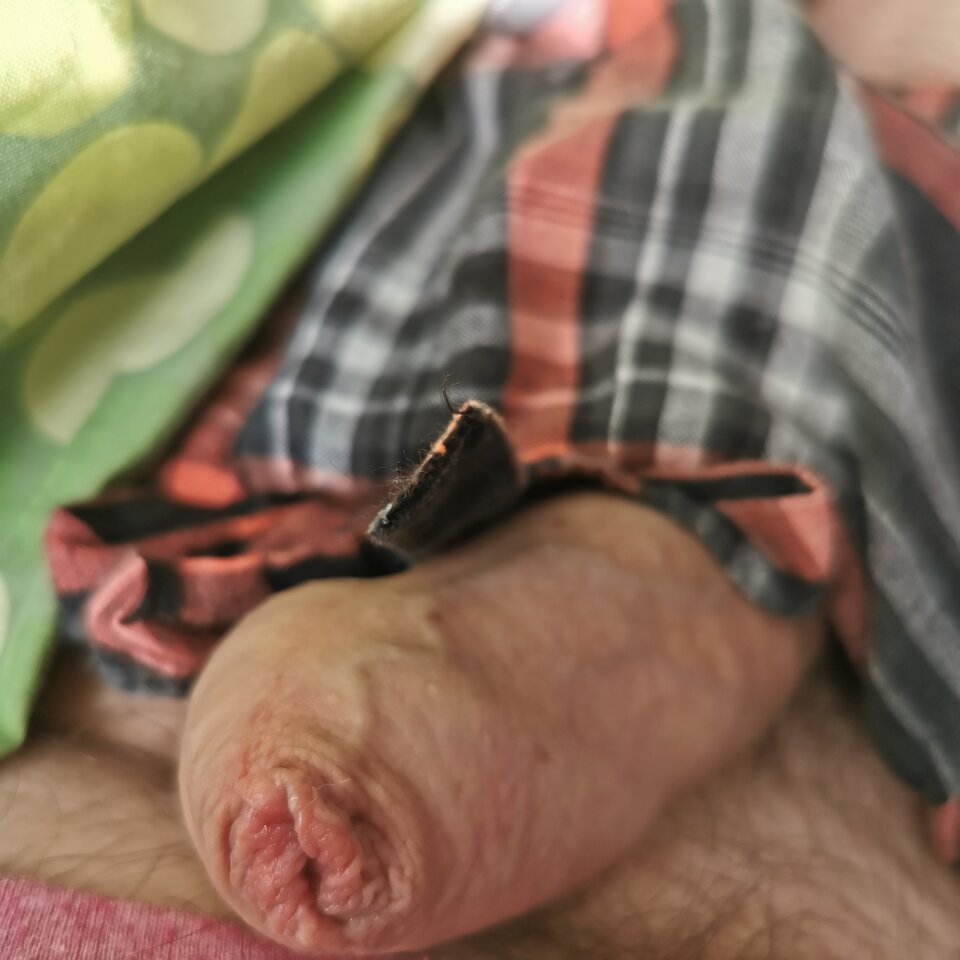 IMG_20220801_074146.jpg - Zi0001