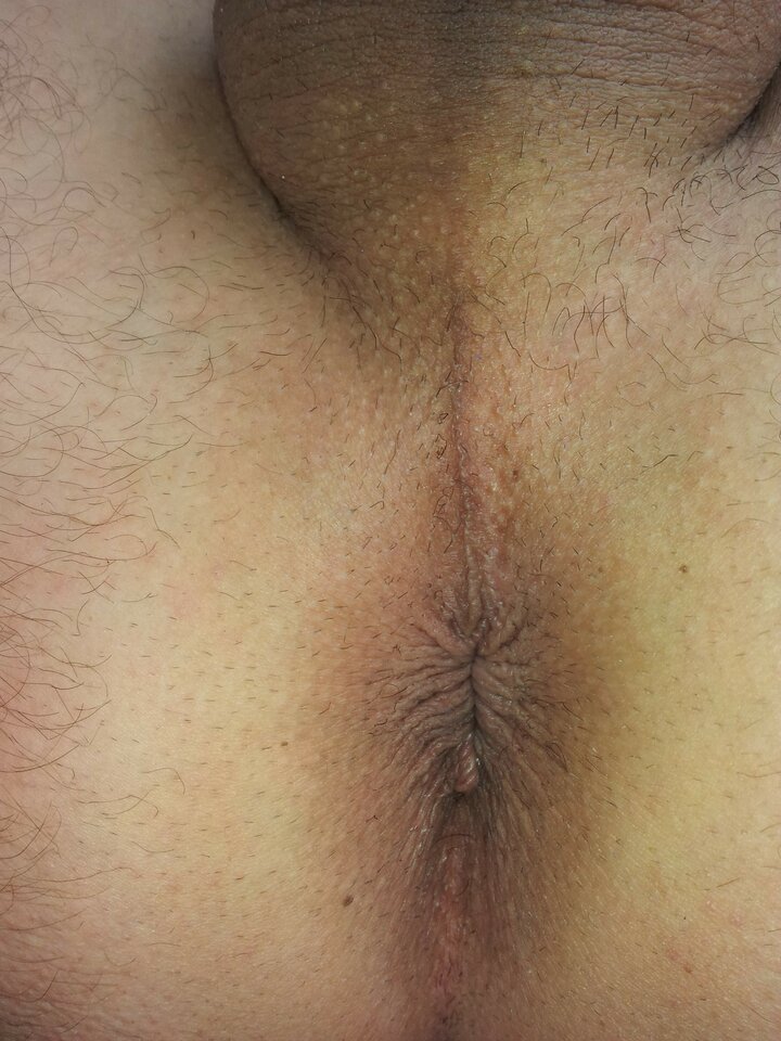 zmniejszane_030.jpg - blood001