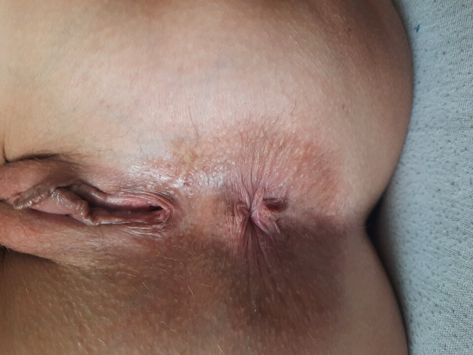 20220803_115541.jpg - Lackyluuk69