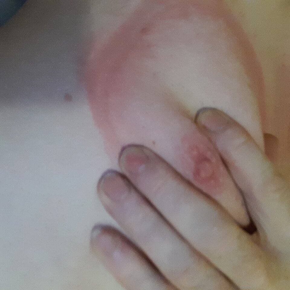 16600782219395871837429049871049.jpg - Palciusia