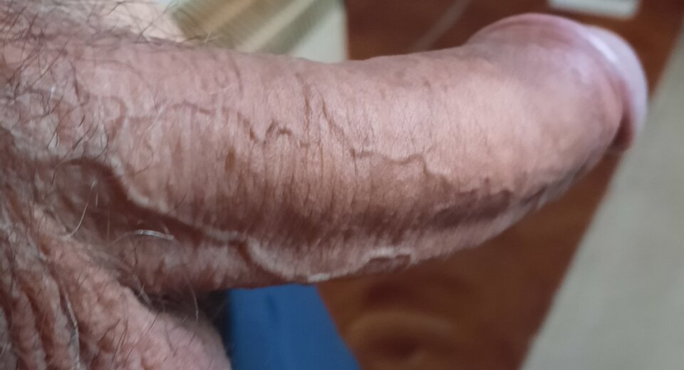 20220908_070308.jpg - smok65