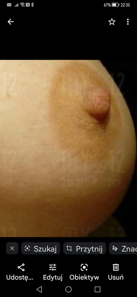 Screenshot_20220920_223541_com.google.android.apps.photos.jpg - Dyziole