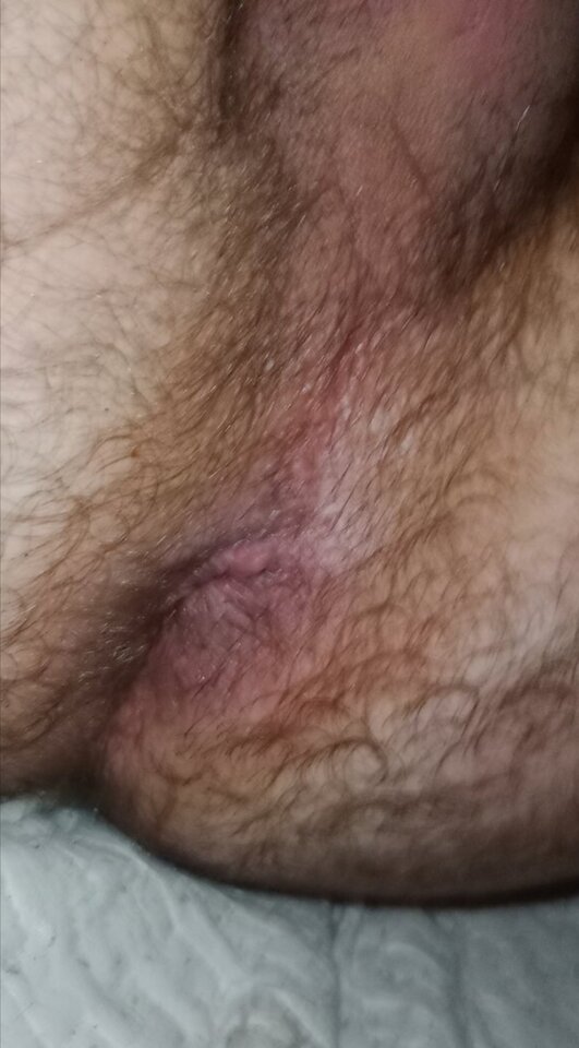 IMG_20221008_063938.jpg - uleglysamotny