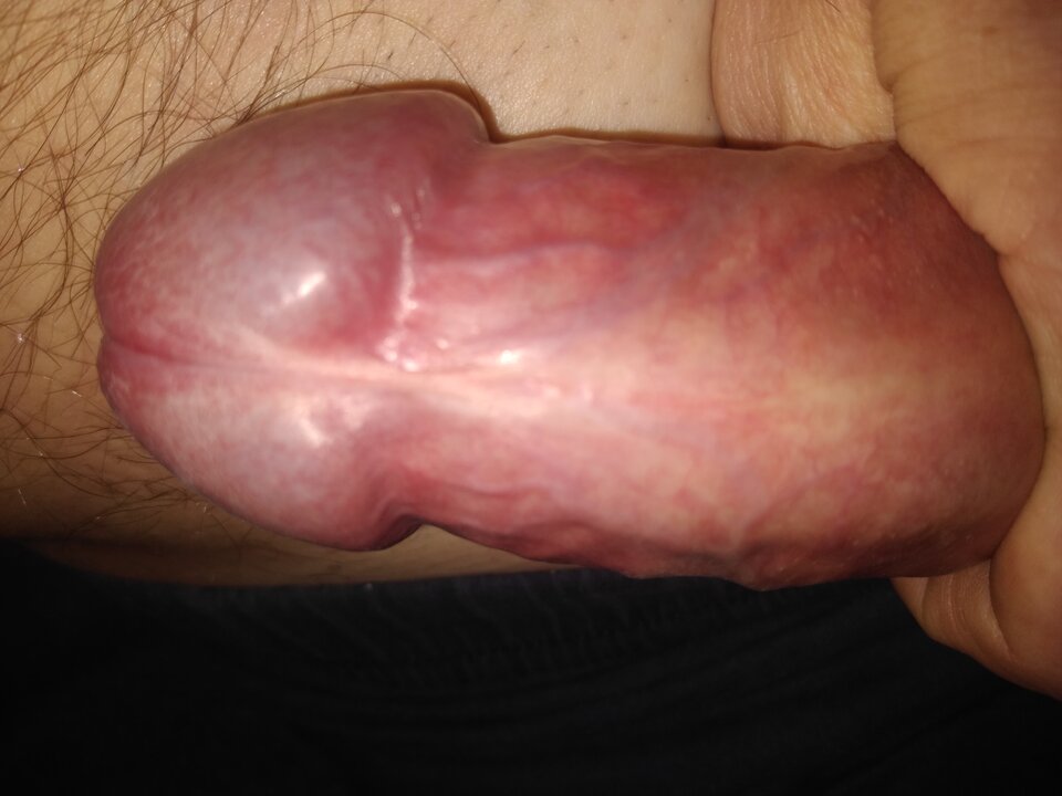 16665128505685617644698449323716.jpg - twoeyes