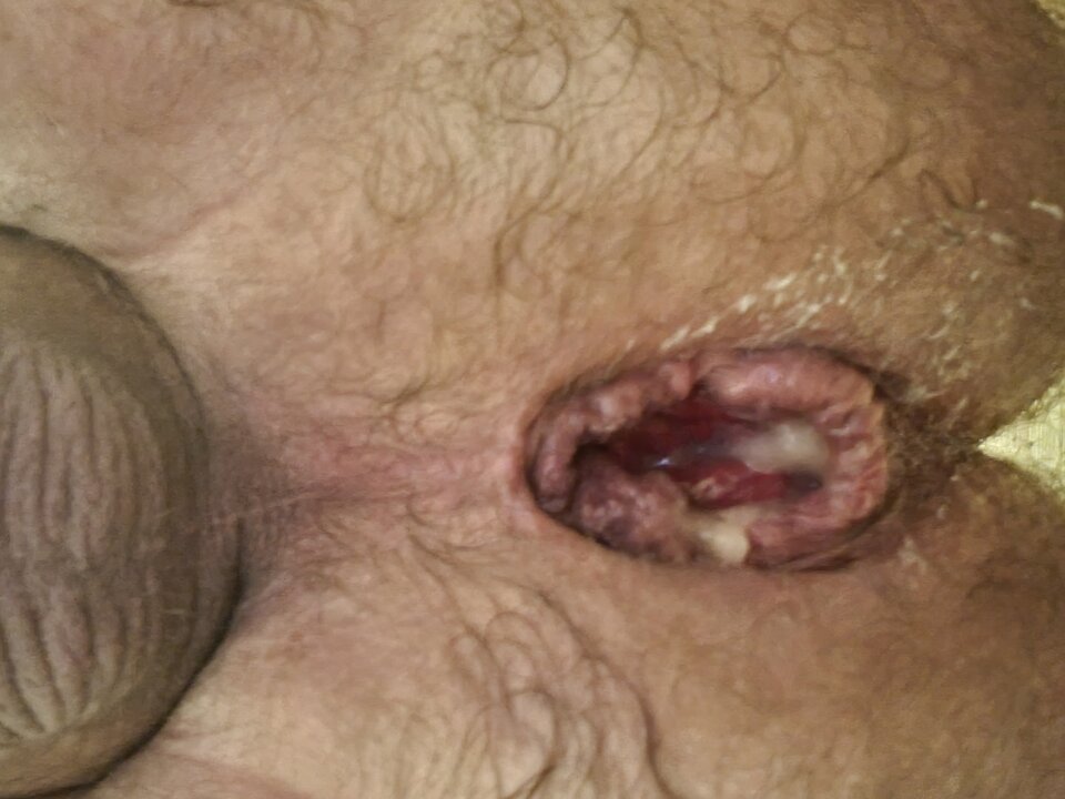 naturalnie otwarta, kto użyje? - fistman