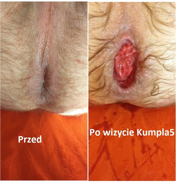 dziura.jpg - wlochaty81