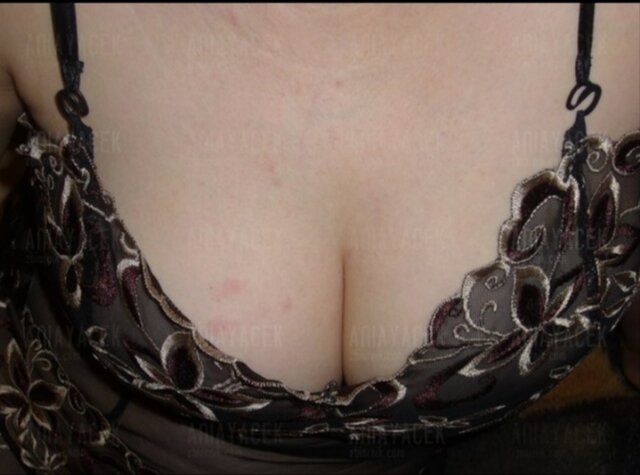 IMG_20221125_233536.jpg - Rzaniaion