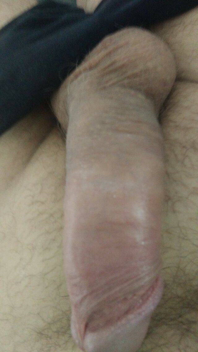 Endriuuu1981