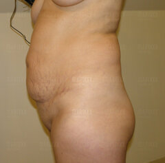 Zima źle na nią wpływa