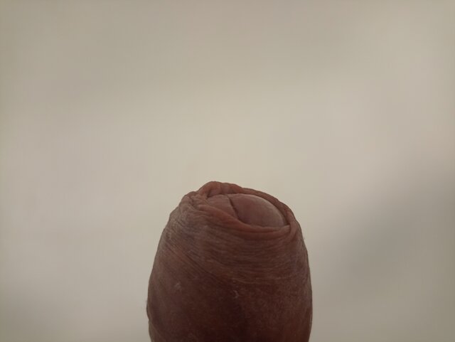 Matioss