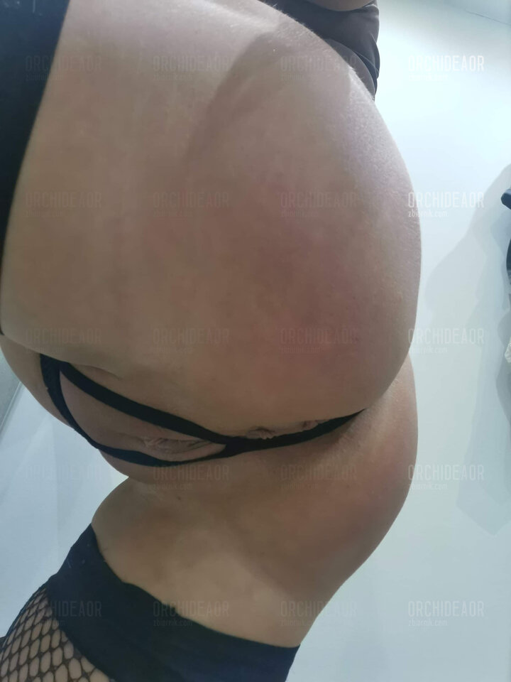 💦❤️ - orchideaor