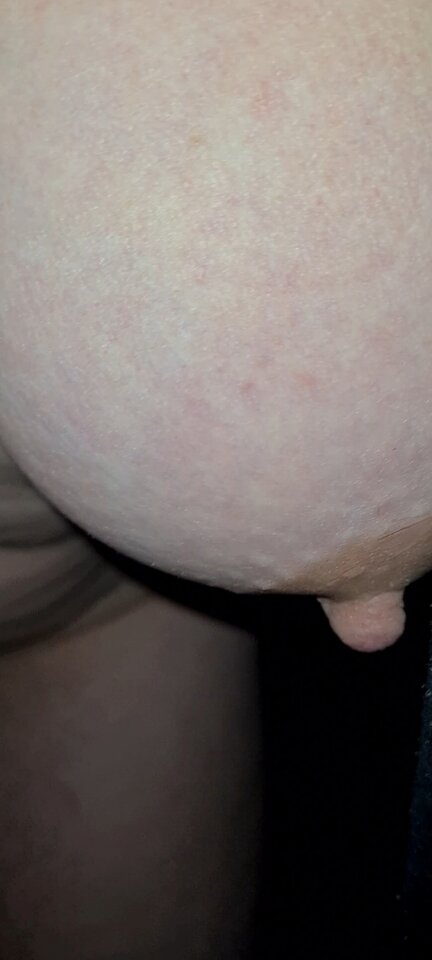 Screenshot_20230406_105258_Gallery.jpg - parasexmv