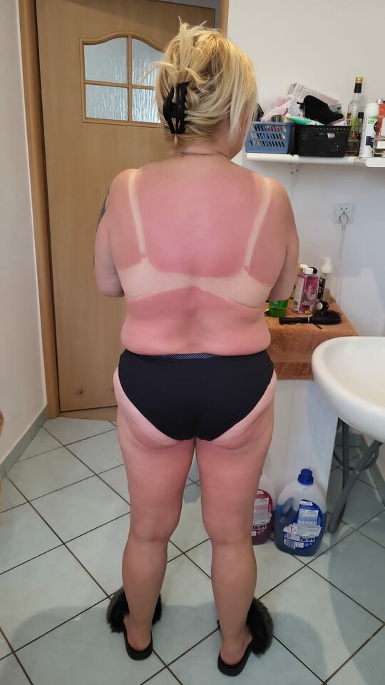 Trochę się przypaliłam - parka7576