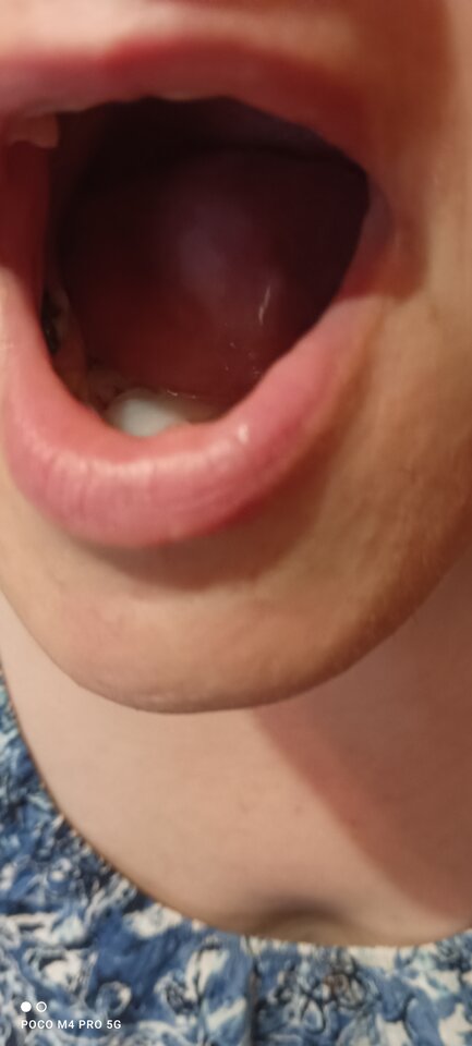 IMG_20230711_204657.jpg - Napaleni75