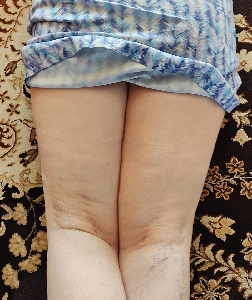 IMG_20230622_163622.jpg - jogan