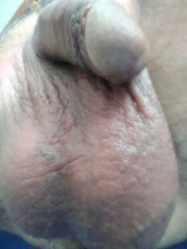 IMG_20230826_125648.jpg - maly140mm