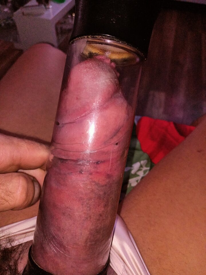 IMG20230828063601.jpg - Burura75