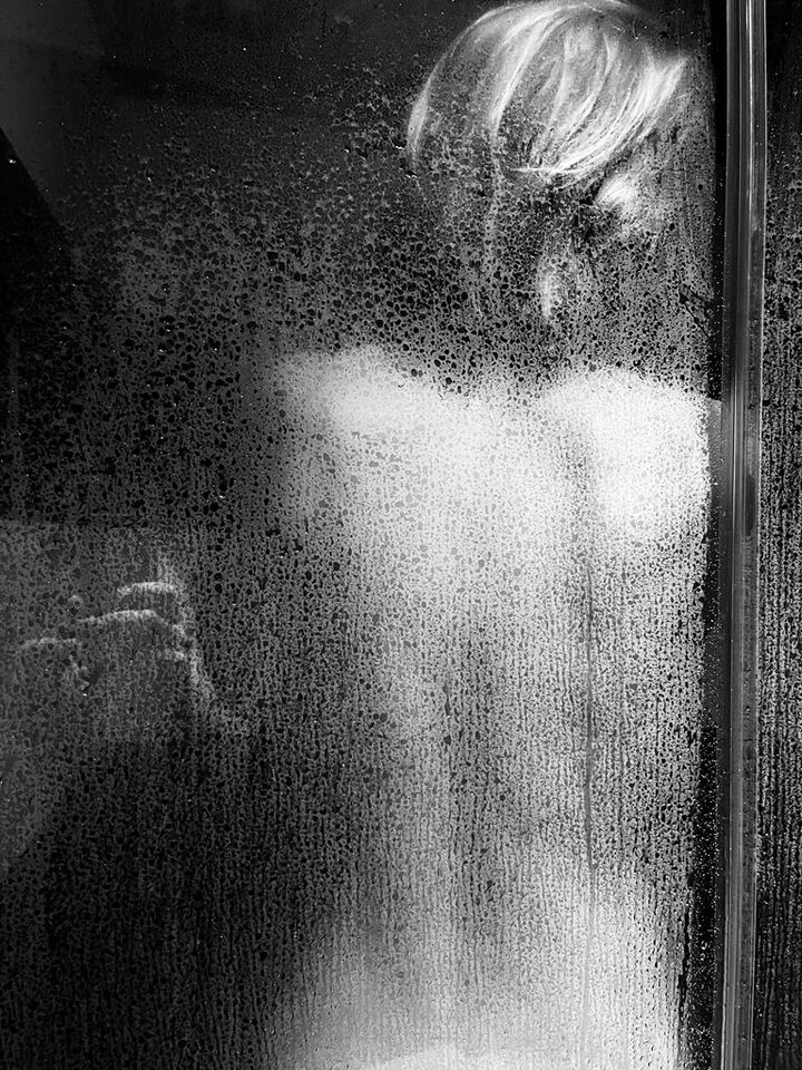 trisome.jpg - trisomia