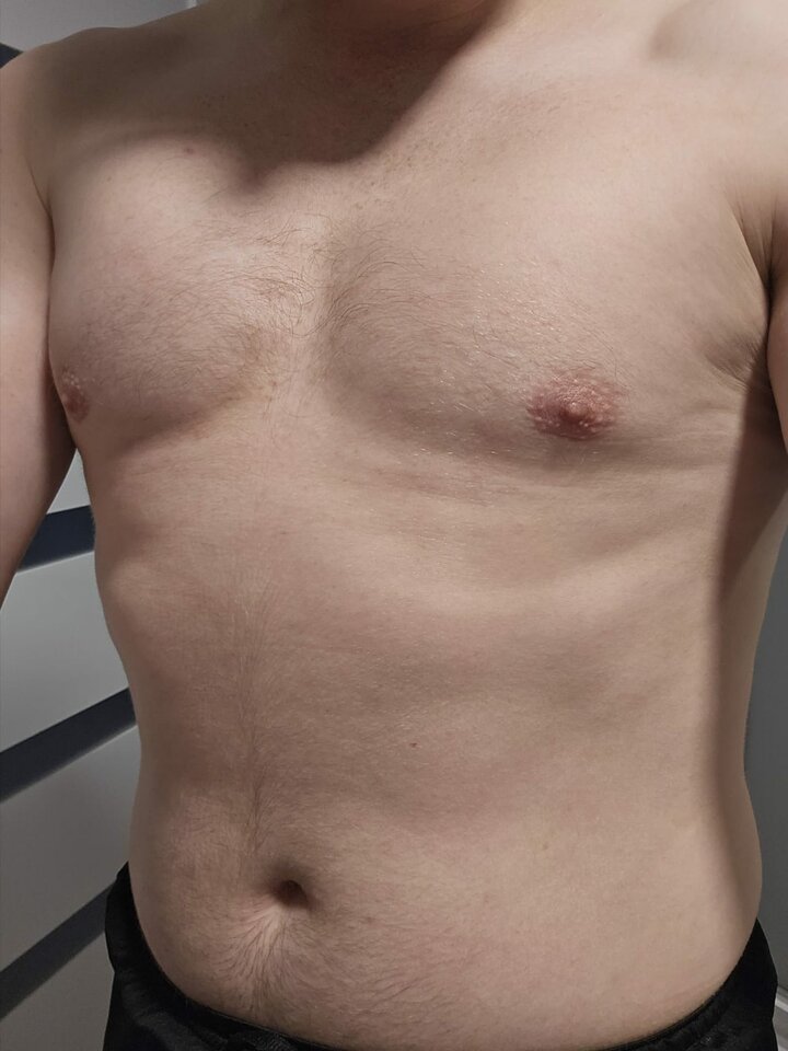 Klata jak u pirata ☠️💣 - NickFury2022